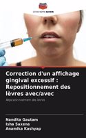Correction d'un affichage gingival excessif