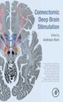 Connectomic Deep Brain Stimulation
