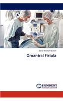 Oroantral Fistula