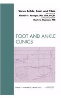 Varus Foot, Ankle, and Tibia, An Issue of Foot and Ankle Clinics