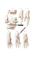 Disarticulation of the Four Fingers and of the Thumb Composition Notebook