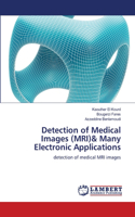 Detection of Medical Images (MRI)& Many Electronic Applications