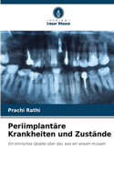 Periimplantäre Krankheiten und Zustände