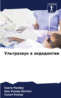 Ультразвук в эндодонтии