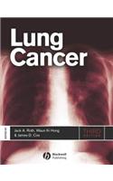 Lung Cancer