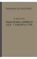 Praktisches Lehrbuch der Tuberkulose: (5 Fachbücher für Ärzte)