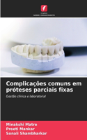 Complicações comuns em próteses parciais fixas