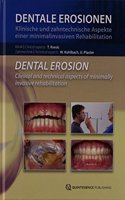 Dental Erosion: Clinical and Technical Aspects of Minimally Invasive Rehabilitation