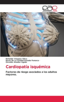 Cardiopatía isquémica