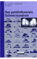 Das Patellofemorale Schmerzsyndrom