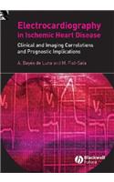 Electrocardiography in Ischemic Heart Disease