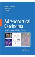 Adrenocortical Carcinoma