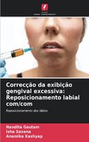 Correcção da exibição gengival excessiva