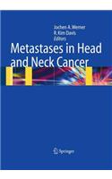 Metastases in Head and Neck Cancer
