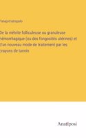 De la métrite folliculeuse ou granuleuse hémorrhagique (ou des fongosités utérines) et d'un nouveau mode de traitement par les crayons de tannin