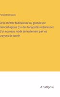 De la métrite folliculeuse ou granuleuse hémorrhagique (ou des fongosités utérines) et d'un nouveau mode de traitement par les crayons de tannin