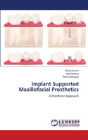 Implant Supported Maxillofacial Prosthetics