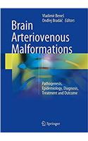 Brain Arteriovenous Malformations