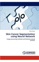 Skin Cancer Segmentation using Neural Network