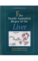 Fine Needle Aspiration Biopsy of the Liver