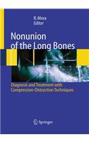 Nonunion of the Long Bones