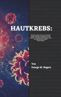 Hautkrebs: Ein Buch, das Ihnen ein besseres Verständnis darüber vermittelt, was Hautkrebs ist, seine Symptome, Behandlung, Ernährungswahl, Tipps zum Umgang dam