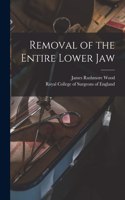 Removal of the Entire Lower Jaw