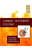 Lumbar Interbody Fusions
