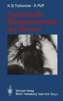 Funktionelle Rontgenanatomie Des Herzens