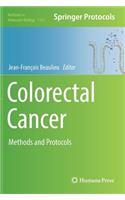 Colorectal Cancer