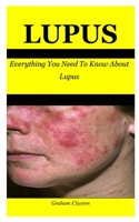 Lupus