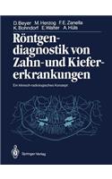 Röntgendiagnostik Von Zahn- Und Kiefererkrankungen