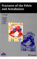 Fractures of the Pelvis and Acetabulum