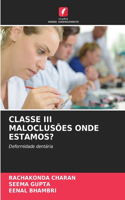 Classe III Maloclusões Onde Estamos?