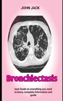 Bronchiectasis