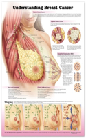 Understanding Breast Cancer 3E Paper