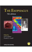 The Esophagus