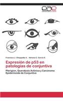 Expresion de P53 En Patologias de Conjuntiva