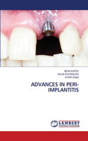 Advances in Peri-Implantitis