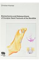 Biomechanics and Osteosynthesis on Condylar Neck Fractures of the Mandible