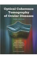 Optical Coherence Tomography of Ocular Diseases