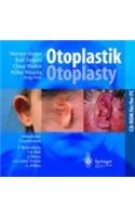 Otoplastik / Otoplasty