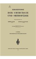 Habituelle Schulterluxation