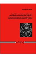Zwei Falle Von Hohlraumbildung Im Telencephalon Menschlicher Gehirne - Eine Makroskopische, Histologische Und Magnetresonanztomographische Analyse