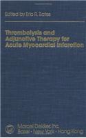 Thrombolysis and Adjunctive Therapy for Acute Myocardial Infarction