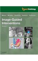 Image-Guided Intervention