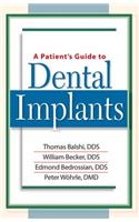 A Patient's Guide to Dental Implants