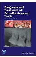 Diagnosis and Treatment of Furcation-Involved Teeth