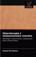 Skleroterapia z zastosowaniem cewnika