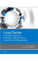 Lung Cancer: A Practical Approach to Evidence-Based Clinical Evaluation and Management